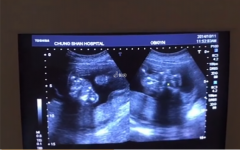 孕早期孕酮正常数值参考，附1-3月变化范围介绍
