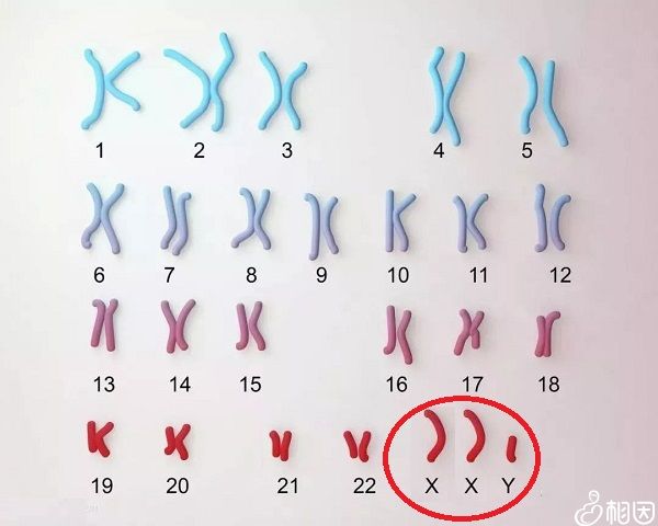染色体XXY